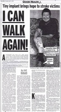 STIMuSTEP Daily Mail article